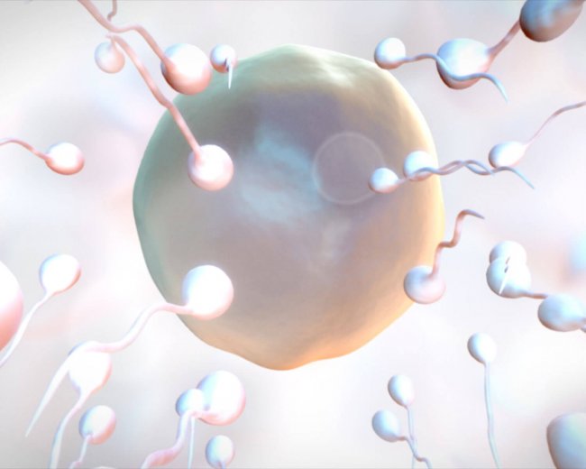 מהי אזוספרמיה